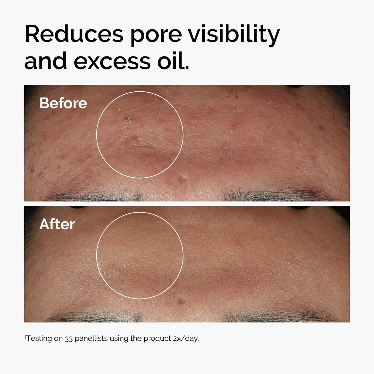 The Ordinary Niacinamide 10% + Zinc 1% – 30 ml